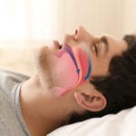 Apneia do sono: pneumologista comenta novo tratamento